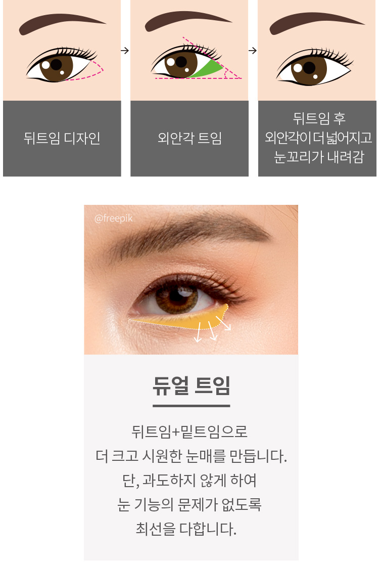 뒤트임 디자인 > 외안각 트임 > 뒤트임 후 외안각이 더 넓어지고 눈꼬리가 내려감. 듀얼 트임 : 뒤트임+밑트임으로 더 크고 시원한 눈매를 만듭니다. 단, 과도하지 않게 하여 눈 기능의 문제가 없도록 최선을 다합니다.